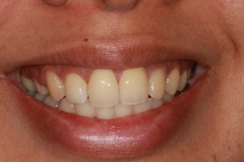 After - Cheadle Hulme Dental