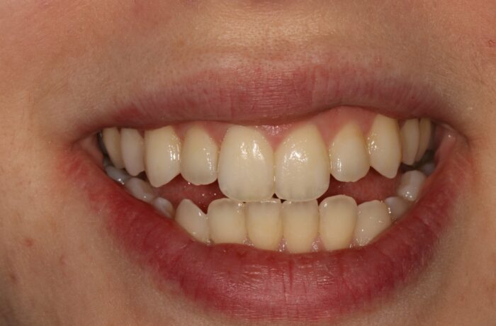 After - Cheadle Hulme Dental