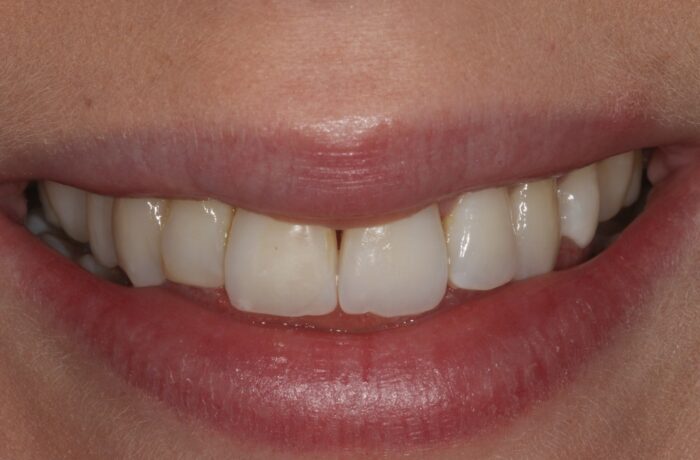 After - Cheadle Hulme Dental