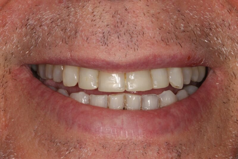After - Cheadle Hulme Dental