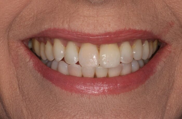 After - Cheadle Hulme Dental