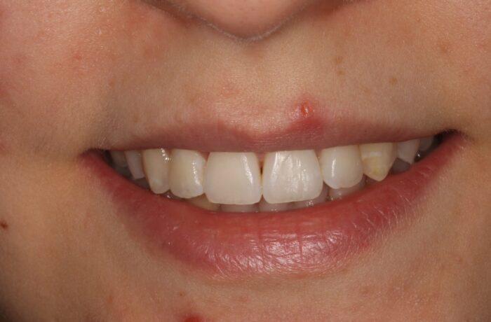 After - Cheadle Hulme Dental