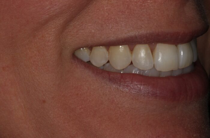 After - Cheadle Hulme Dental