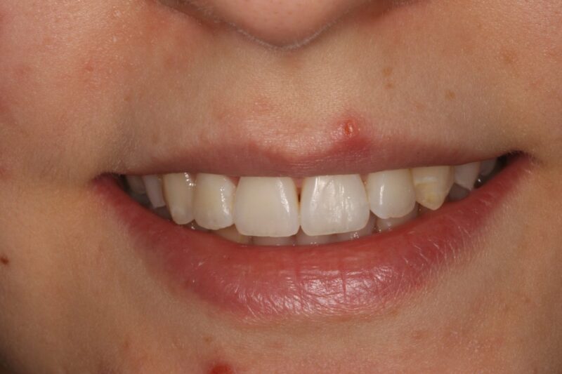 After - Cheadle Hulme Dental