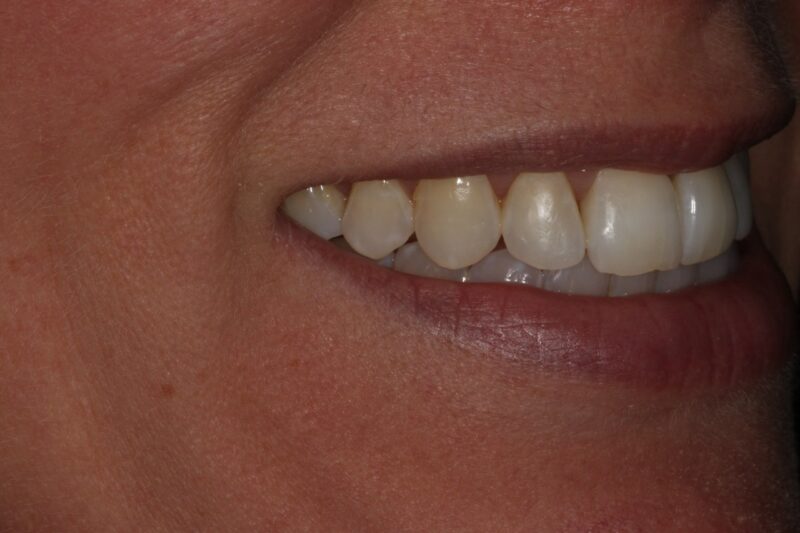 After - Cheadle Hulme Dental