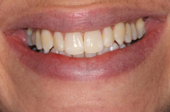 After - Cheadle Hulme Dental