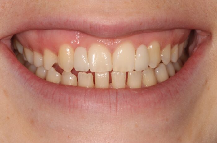 After - Cheadle Hulme Dental
