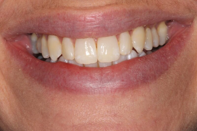 After - Cheadle Hulme Dental