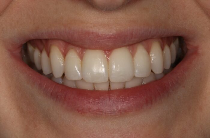 After - Cheadle Hulme Dental