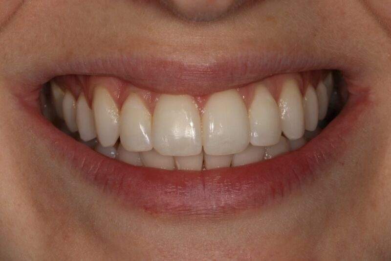 After - Cheadle Hulme Dental