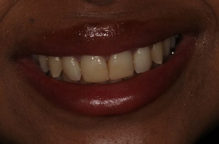 After - Cheadle Hulme Dental