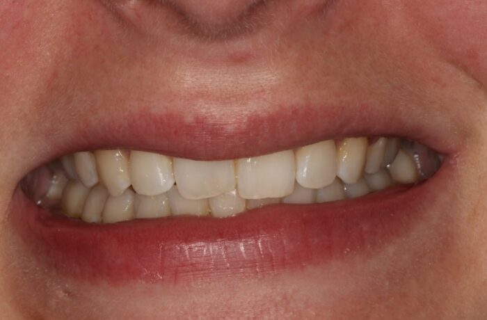 After - Cheadle Hulme Dental