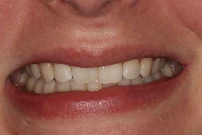 After - Cheadle Hulme Dental