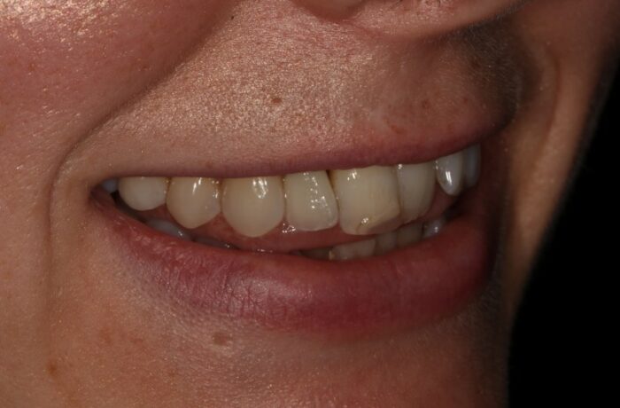 After - Cheadle Hulme Dental