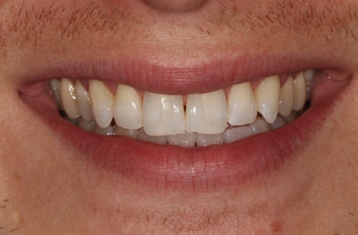 After - Cheadle Hulme Dental