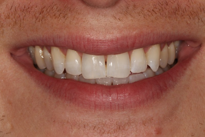 After - Cheadle Hulme Dental