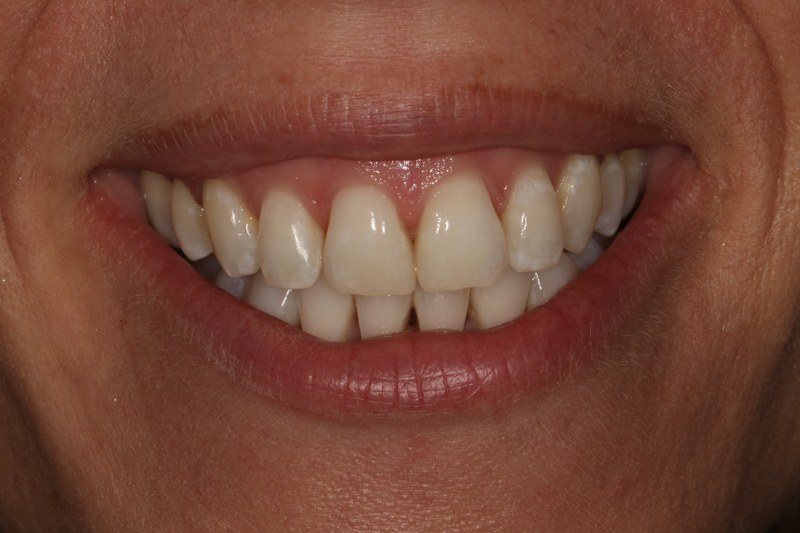 After - Cheadle Hulme Dental