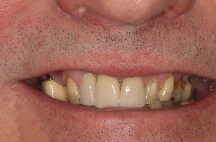After - Cheadle Hulme Dental