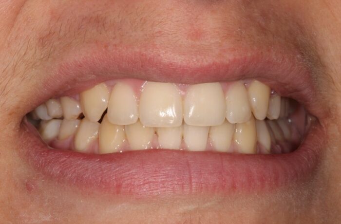 After - Cheadle Hulme Dental