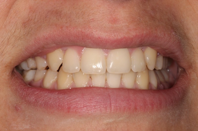 After - Cheadle Hulme Dental