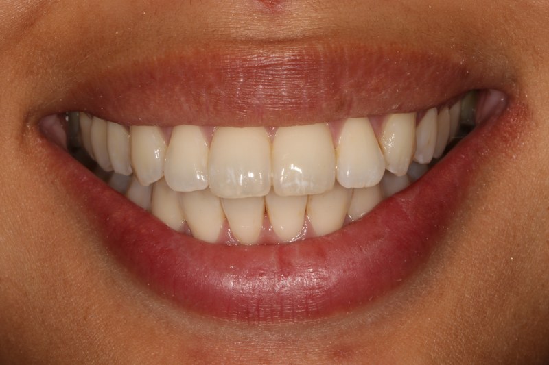 After - Cheadle Hulme Dental