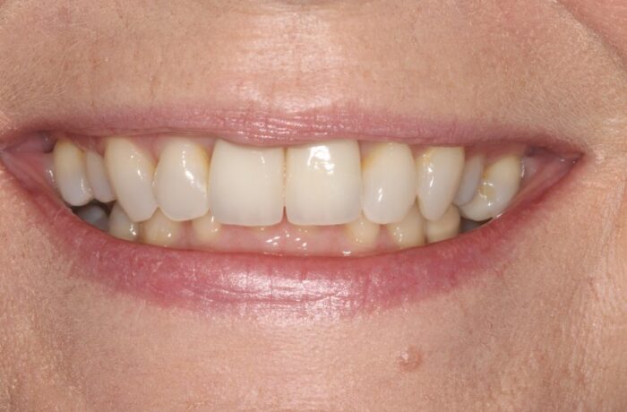 After - Cheadle Hulme Dental