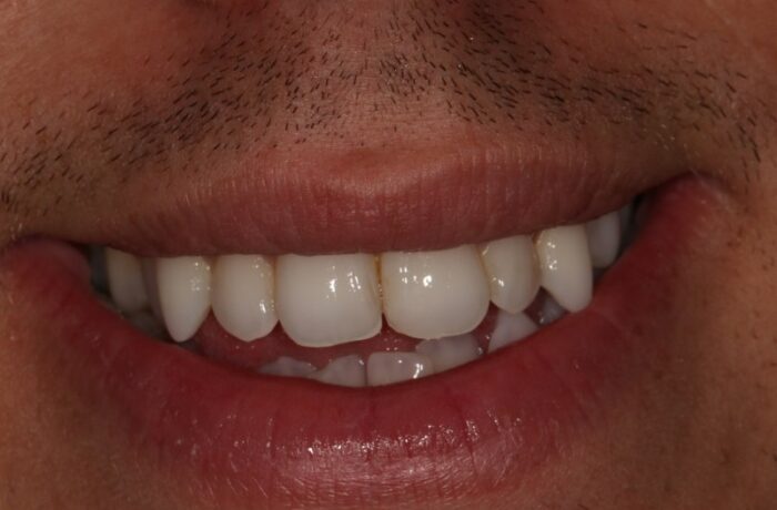 After - Cheadle Hulme Dental
