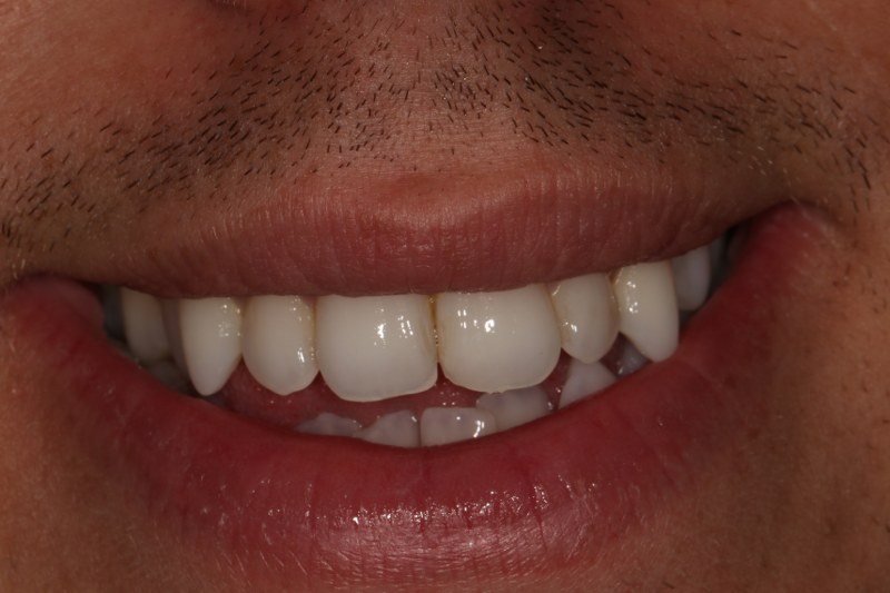 After - Cheadle Hulme Dental