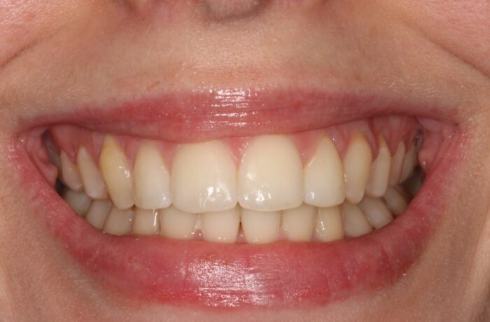 After - Cheadle Hulme Dental