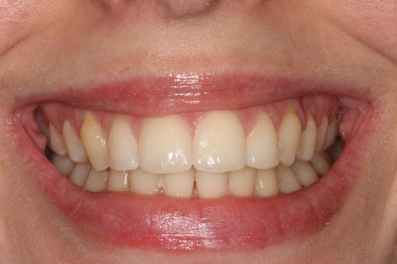 After - Cheadle Hulme Dental