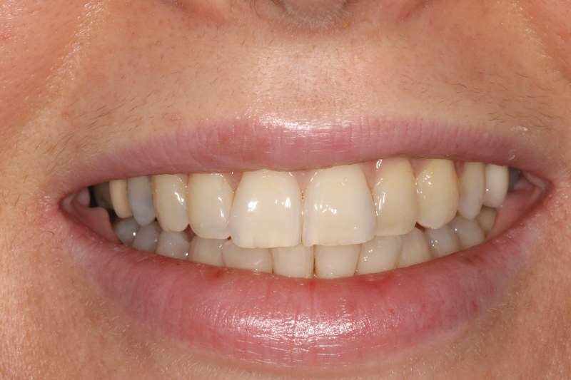 After - Cheadle Hulme Dental