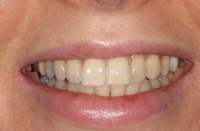 After - Cheadle Hulme Dental