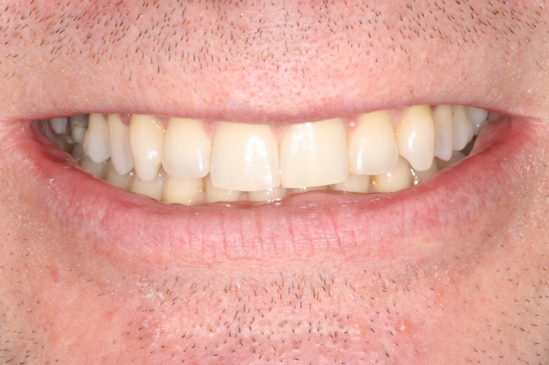 After - Cheadle Hulme Dental