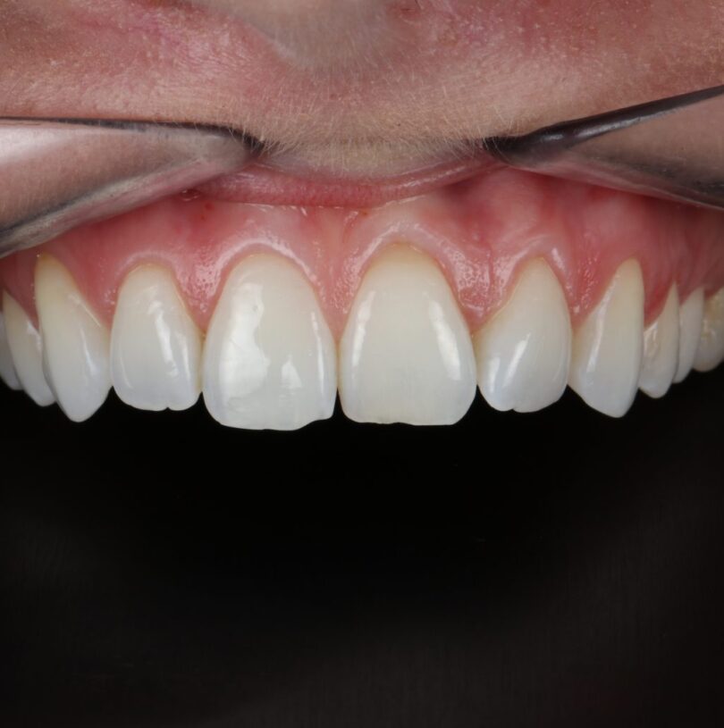 blog - Cheadle Hulme Dental