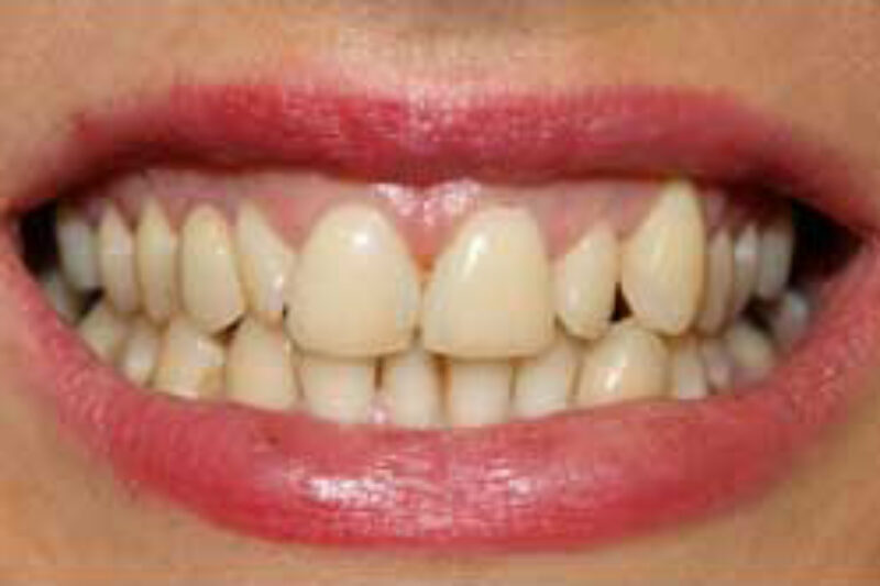 Before - Cheadle Hulme Dental