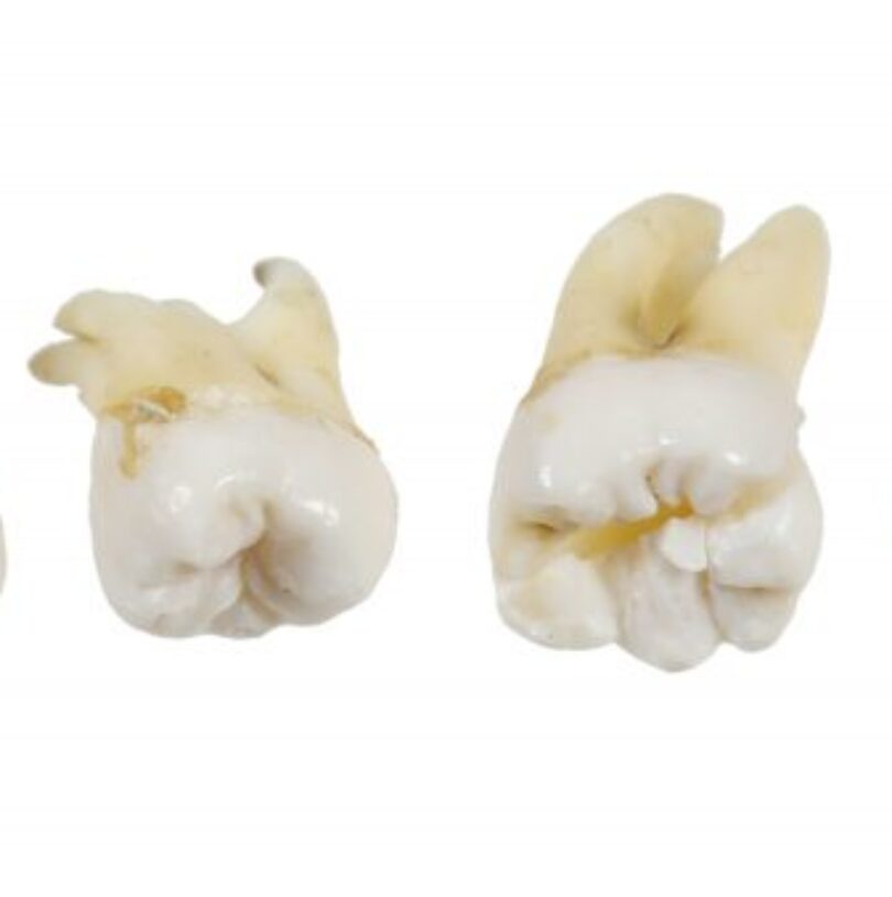 blog - Cheadle Hulme Dental