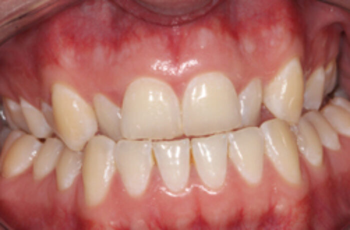 Before - Cheadle Hulme Dental
