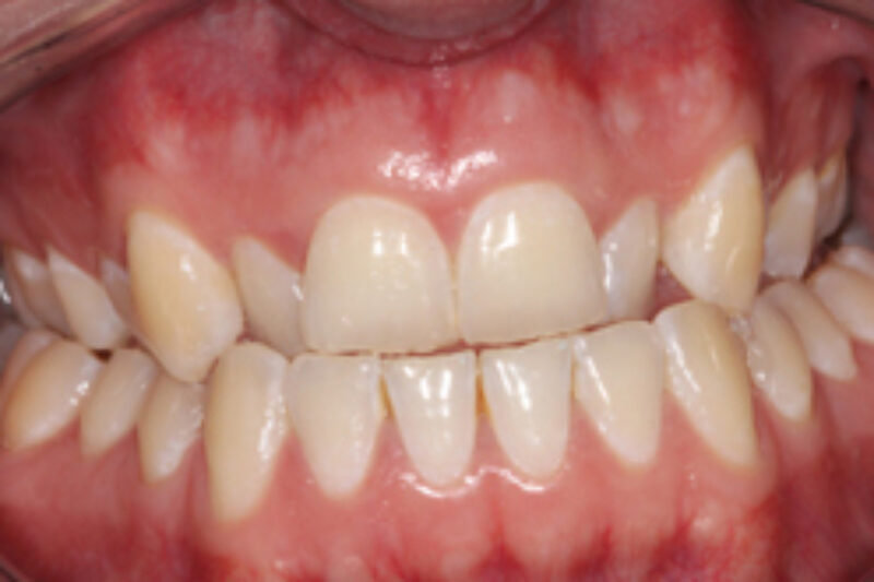 Before - Cheadle Hulme Dental