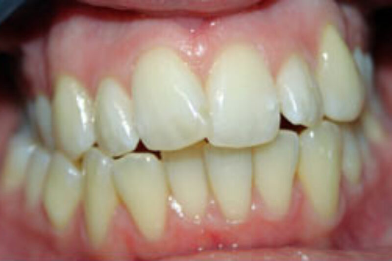 Before - Cheadle Hulme Dental