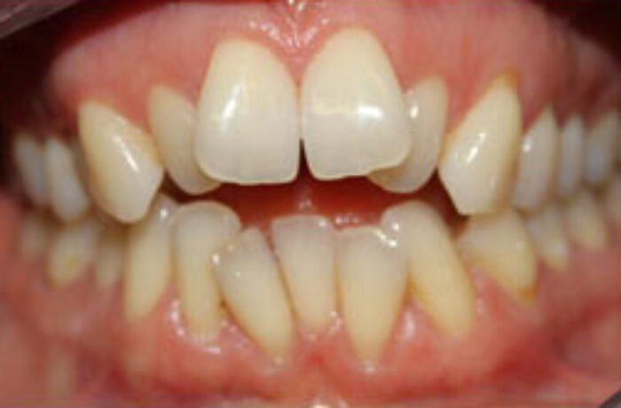 Before - Cheadle Hulme Dental