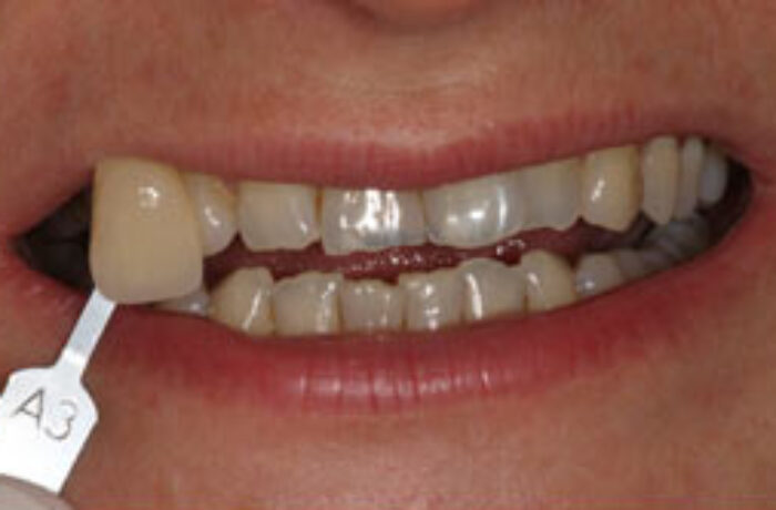 Before - Cheadle Hulme Dental