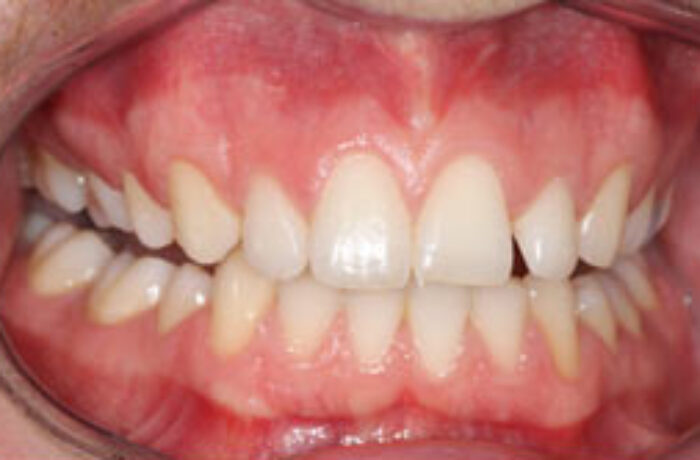 Before - Cheadle Hulme Dental