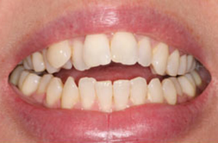 Before - Cheadle Hulme Dental