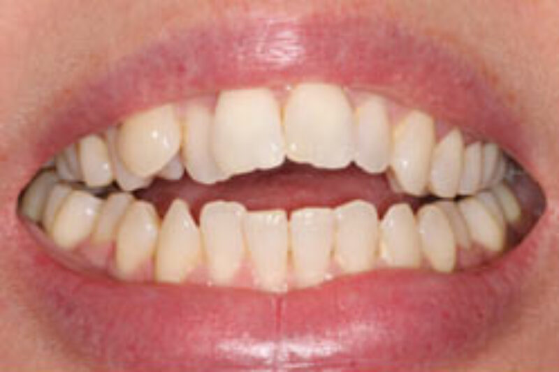 Before - Cheadle Hulme Dental