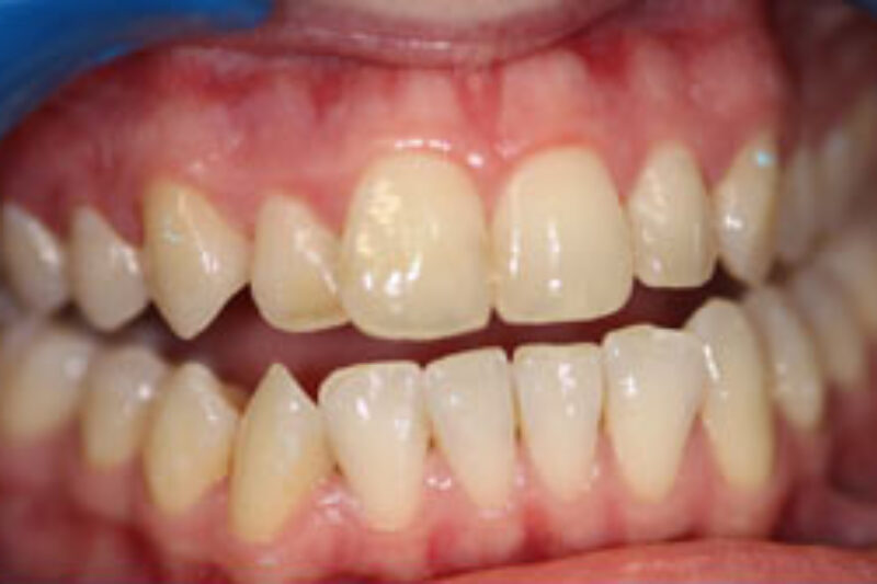 Before - Cheadle Hulme Dental