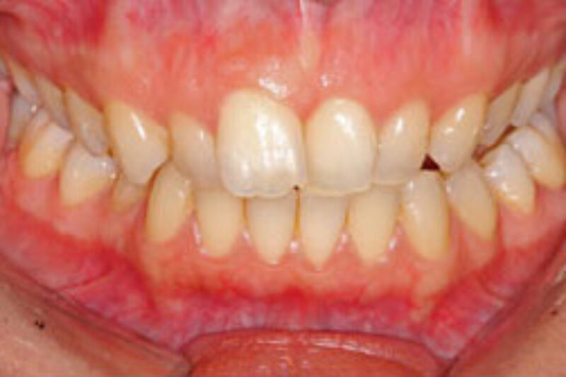 Before - Cheadle Hulme Dental
