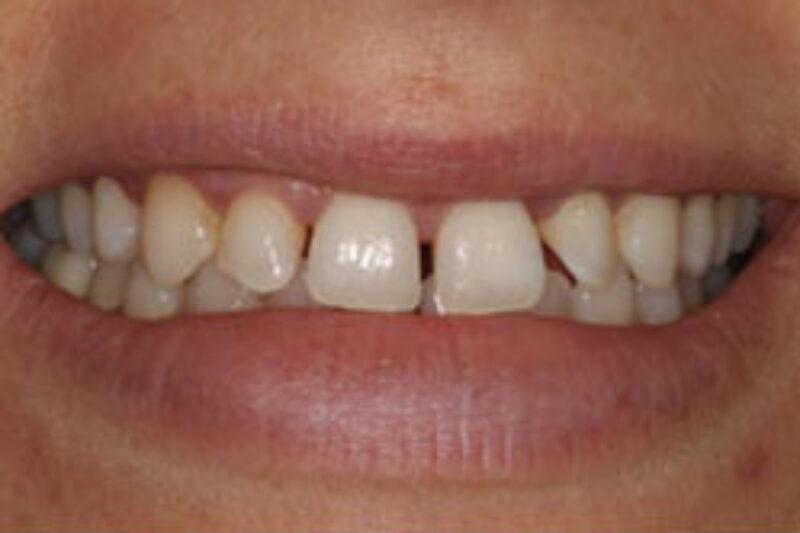 Before - Cheadle Hulme Dental