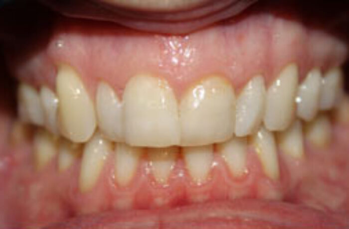 Before - Cheadle Hulme Dental