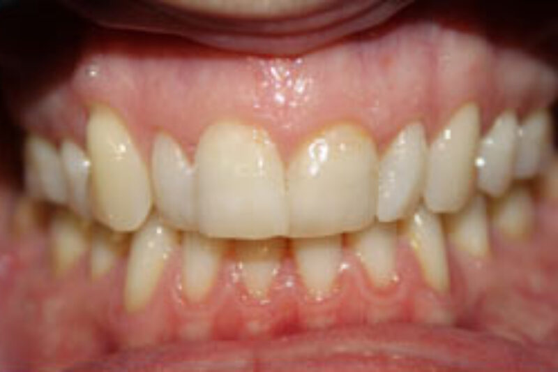 Before - Cheadle Hulme Dental