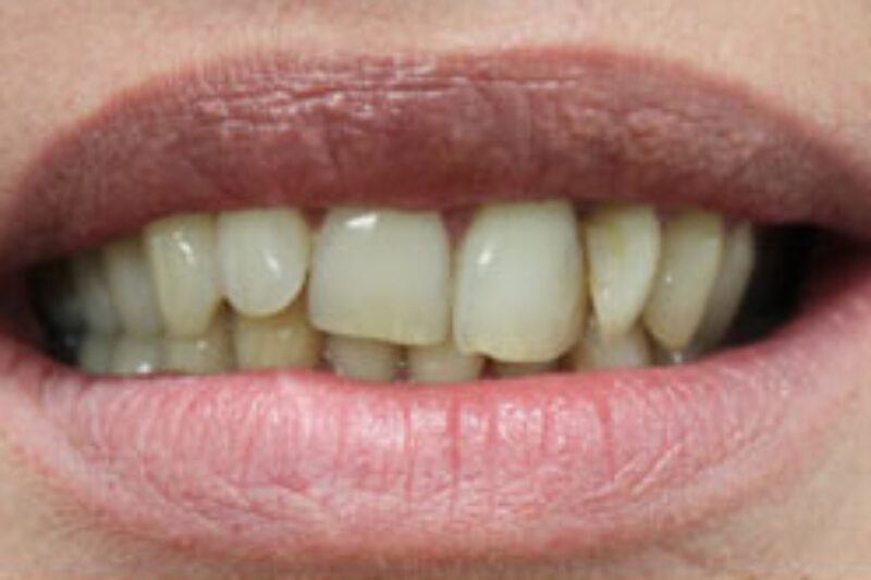 Before - Cheadle Hulme Dental